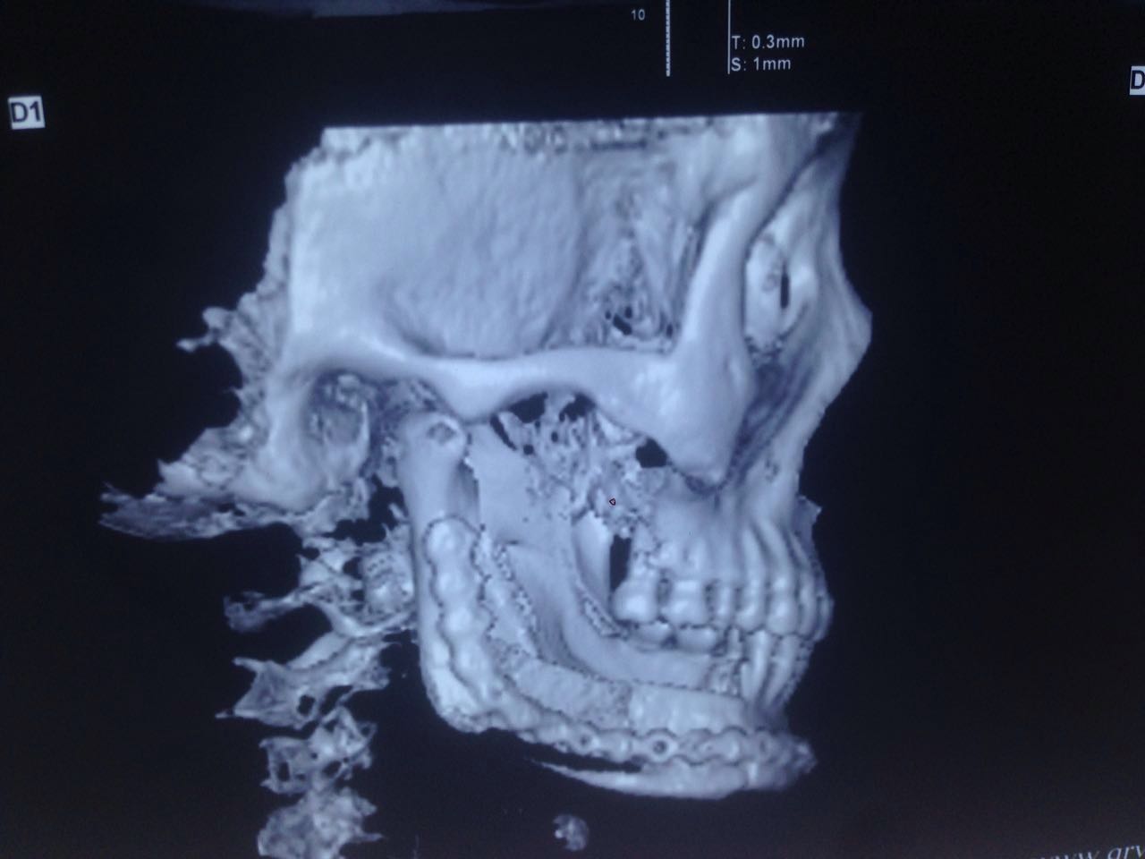Illustration de quelques actes chirurgicaux du Dr Nyimi en Chine