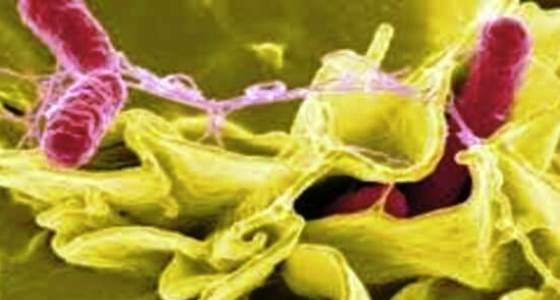 9ème Congrès International sur la Pathologie infectieuse et Parasitaire (CIPIP)