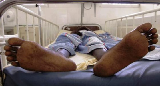 Pratique des Soins Palliatifs à Kinshasa (RDC)