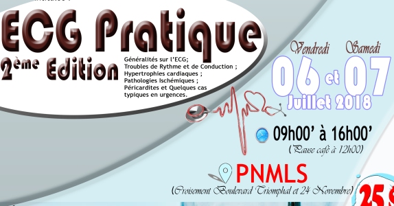 ECG Pratique 2ème édition