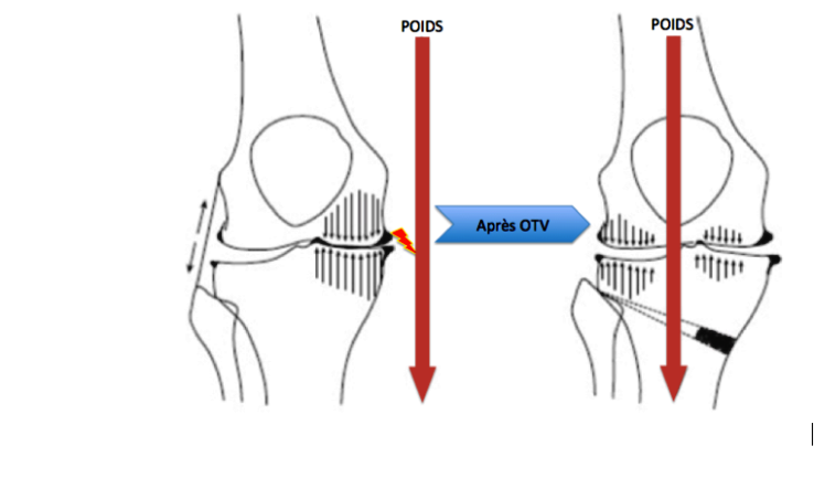 Les Annales Africaines de Médecine (AAM) ont le plaisir d’annoncer la mise en ligne du  volume 13 n°1, décembre 2019